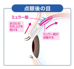 点眼後の目：ミュラー筋が収縮し、まぶたの引き上げを助ける状態